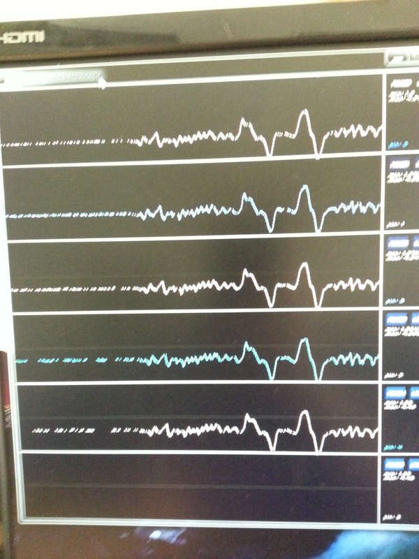 Preliminary GSR results collected from the wrist